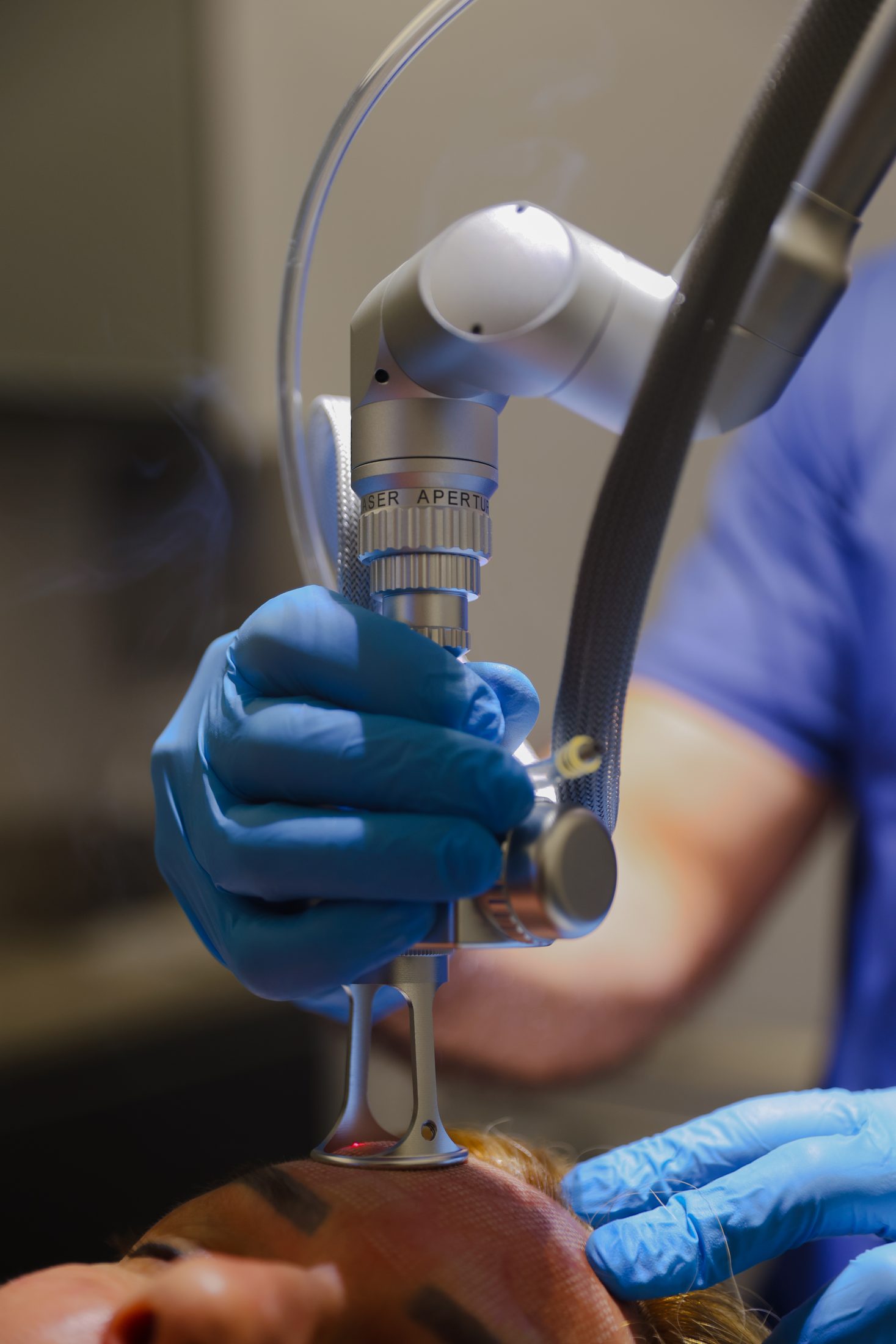 Laser de CO2 — Hospital Espaço da Plástica